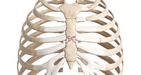 sternum fracture